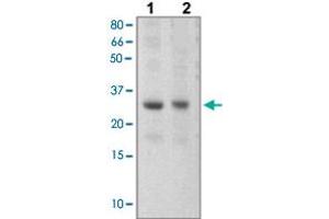 The tissue lysates derived from mouse liver (Lane 1), mouse muscle (Lane 2) were immunoprobed by SOCS3 polyclonal antibody  at 1 : 500. (SOCS3 antibody  (C-Term))