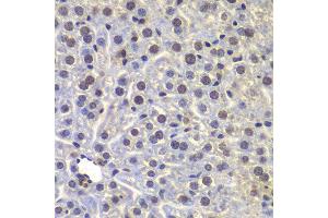 Immunohistochemistry of paraffin-embedded mouse liver using FUBP3 antibody at dilution of 1:100 (40x lens). (FUBP3 antibody)
