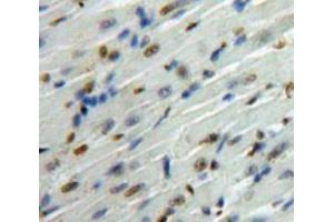 Used in DAB staining on fromalin fixed paraffin-embedded Heart tissue (SMAD6 antibody  (AA 261-495))