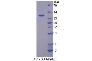 Image no. 1 for Pregnancy Specific beta 1 Glycoprotein 2 (PSG2) (AA 35-335) protein (His tag) (ABIN6237544) (PSG2 Protein (AA 35-335) (His tag))
