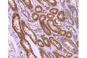 Paraformaldehyde-fixed, paraffin embedded human kidney, Antigen retrieval by boiling in sodium citrate buffer (pH6) for 15min, Block endogenous peroxidase by 3% hydrogen peroxide for 30 minutes, Blocking buffer at 37°C for 20min, Antibody incubation with BCL2A1 (3E4) Monoclonal Antibody  at 1:50 overnight at 4°C, followed by a conjugated secondary and DAB staining. (BCL2A1 antibody)