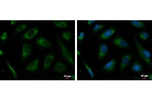 ICC/IF Image PRKCSH antibody detects PRKCSH protein at endoplasmic reticulum by immunofluorescent analysis.