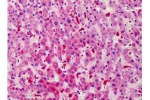 Human Liver: Formalin-Fixed, Paraffin-Embedded (FFPE) (STEAP4 antibody)