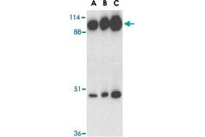 Western blot analysis of ACE2 in human kidney tissue lysate with ACE2 polyclonal antibody  at 0. (ACE2 antibody  (C-Term))