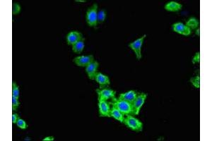 Immunofluorescent analysis of HepG2 cells using ABIN7147577 at dilution of 1:100 and Alexa Fluor 488-congugated AffiniPure Goat Anti-Rabbit IgG(H+L) (CLCN2 antibody  (AA 549-770))