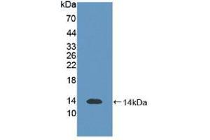 Western blot analysis of recombinant Human S100B. (S100B antibody  (AA 1-92))