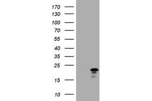 Image no. 1 for anti-Cyclin-Dependent Kinase Inhibitor 2C (p18, Inhibits CDK4) (CDKN2C) antibody (ABIN1497450) (CDKN2C antibody)