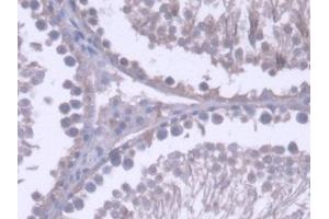 DAB staining on IHC-P; Samples: Rat Testis Tissue (RNASEH2A antibody  (AA 1-301))