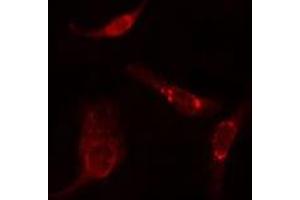 ABIN6275791 staining  HuvEc cells by IF/ICC. (TUBA3C/E antibody)