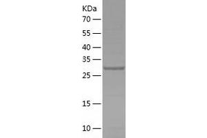 Western Blotting (WB) image for SplA/ryanodine Receptor Domain and SOCS Box Containing 2 (SPSB2) (AA 1-263) protein (His tag) (ABIN7125194) (SPSB2 Protein (AA 1-263) (His tag))