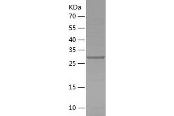 SPSB2 Protein (AA 1-263) (His tag)