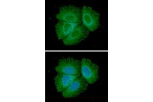 ICC/IF analysis of Adiponectin in Hep3B cells line, stained with DAPI (Blue) for nucleus staining and monoclonal anti-human Adiponectin antibody (1:100) with goat anti-mouse IgG-Alexa fluor 488 conjugate (Green). (ADIPOQ antibody  (AA 15-244))