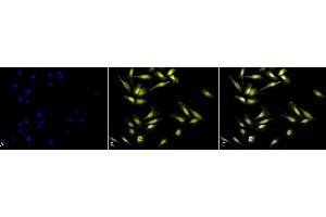 Immunocytochemistry/Immunofluorescence analysis using Rabbit Anti-Calreticulin Polyclonal Antibody (ABIN361834 and ABIN361835). (Calreticulin antibody)