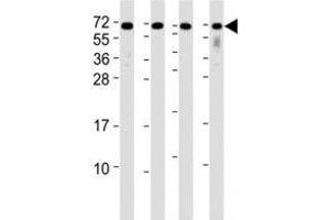 Western Blotting (WB) image for anti-CD63 (CD63) (AA 163-190) antibody (ABIN3030409)