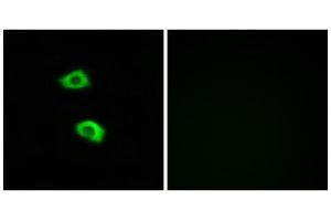 Immunofluorescence analysis of LOVO cells, using OR51B5 antibody. (OR51B5 antibody  (Internal Region))