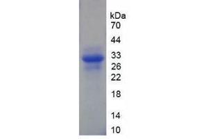 SDS-PAGE analysis of Human XPG Protein.