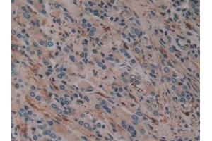Immunohistochemistry (IHC) image for anti-Coagulation Factor XIII, A1 Polypeptide (F13A1) (AA 107-345) antibody (ABIN7433159)
