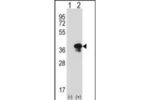 Western blot analysis of STX3 (arrow) using rabbit polyclonal STX3 Antibody (Center) (ABIN389321 and ABIN2839439). (STX3 antibody  (AA 178-205))