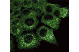 Immunofluorescence staining of A431 cells (Human epithelial carcinoma, ATCC CRL-1555). (HSPA4 antibody  (AA 703-858))