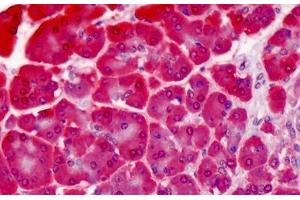 Human Pancreas: Formalin-Fixed, Paraffin-Embedded (FFPE) (Hsc70 antibody)