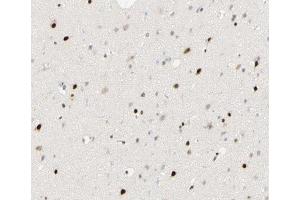 ABIN6266895 at 1/100 staining human brain tissue sections by IHC-P. (FOXJ3 antibody  (C-Term))