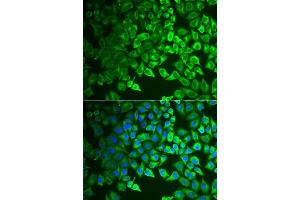 Immunofluorescence analysis of  cells using GIF antibody (ABIN6130975, ABIN6141081, ABIN6141082 and ABIN6222649). (Intrinsic Factor antibody  (AA 20-300))