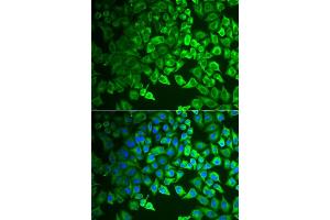 Immunofluorescence analysis of  cells using GIF antibody (ABIN6130975, ABIN6141081, ABIN6141082 and ABIN6222649).