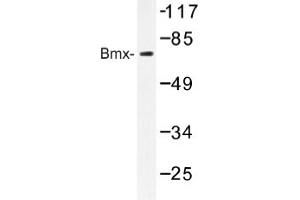 Image no. 1 for anti-BMX Non-Receptor Tyrosine Kinase (BMX) antibody (ABIN317608) (BMX antibody)