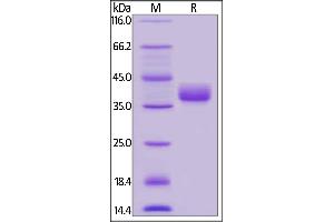 Human CD52, Fc Tag on  under reducing (R) condition. (CD52 Protein (CD52) (AA 25-36) (Fc Tag))