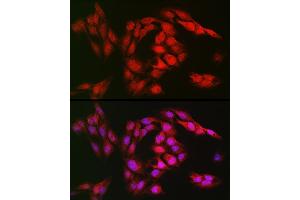 Immunofluorescence analysis of U2OS cells using SOD1 Rabbit pAb (ABIN3020854, ABIN3020855, ABIN3020856 and ABIN6213758) at dilution of 1:150 (40x lens).