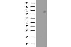 HEK293T cells were transfected with the pCMV6-ENTRY control (Left lane) or pCMV6-ENTRY FBXO21 (Right lane) cDNA for 48 hrs and lysed. (FBXO21 antibody)