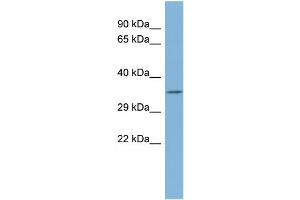 WB Suggested Anti-TTC35 Antibody Titration:  0. (TTC35 antibody  (Middle Region))