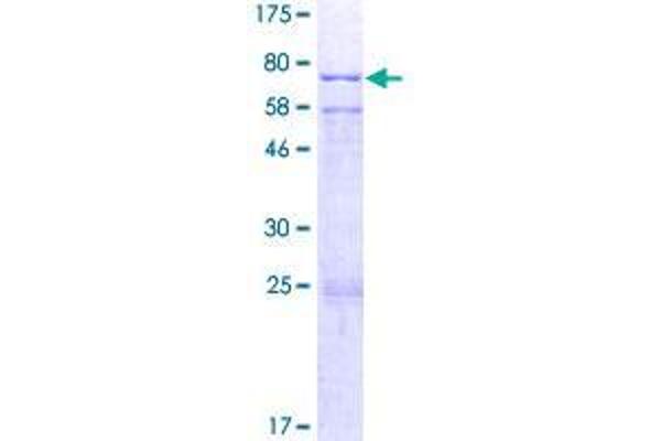 CYP20A1 Protein (AA 1-462) (GST tag)