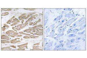 Immunohistochemistry (IHC) image for anti-Brain Protein 44-Like (BRP44L) (N-Term) antibody (ABIN1850936) (BRP44L antibody  (N-Term))