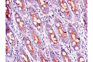 Immunohistochemistry of paraffin-embedded human small intestine tissue using ABIN7167318 at dilution of 1:100 (RAB39B antibody  (AA 1-213))