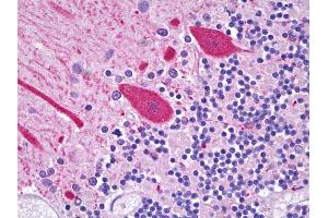 Anti-CES2 / Esterase antibody IHC of human brain, cerebellum, Purkinje cells. (CES2 antibody  (C-Term))