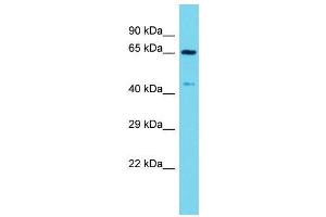 Host:  Rabbit  Target Name:  Arntl  Sample Type:  Mouse Stomach lysates  Antibody Dilution:  1. (ARNTL antibody  (C-Term))