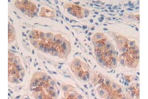DAB staining on IHC-P; Samples: Human Stomach Tissue (IL-20 antibody  (AA 25-176))
