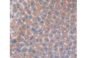 Used in DAB staining on fromalin fixed paraffin- embedded Kidney tissue (Vitronectin antibody  (AA 19-468))