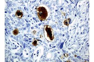 Image no. 2 for anti-WAP Four-Disulfide Core Domain 2 (WFDC2) (AA 31-124) antibody (ABIN1491389) (WFDC2 antibody  (AA 31-124))