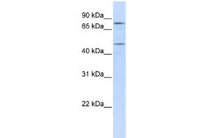 WB Suggested Anti-ERCC8 Antibody Titration: 0.