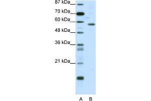 WB Suggested Anti-YY1 Antibody Titration:  0. (YY1 antibody  (N-Term))