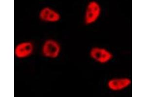 ABIN6267040 staining A431 cells by IF/ICC. (p53 antibody  (N-Term))