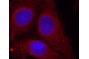 Immunofluorescence analysis of methanol-fixed HeLa cells using Phospho-GAP43(S41) Polyclonal Antibody (GAP43 antibody  (pSer41))
