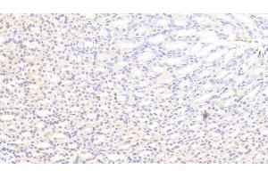 Immunohistochemistry (IHC) image for anti-Complement Component 5a (C5a) (AA 1-77) antibody (ABIN7438799)