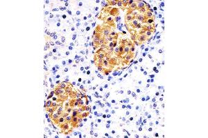 Paraformaldehyde-fixed, paraffin embedded human pancreas tissue, Antigen retrieval by boiling in sodium citrate buffer (pH6. (RAB3B antibody)