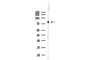 Western blot analysis of lysates from Rat brain, using MeCP2 Antibody at 1/1000 dilution.
