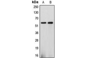 Western blot analysis of Cytochrome P450 2J2 expression in HepG2 (A), A549 (B) whole cell lysates.