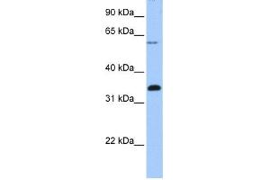 WB Suggested Anti-FBXO16 Antibody Titration: 0. (FBXO16 antibody  (C-Term))