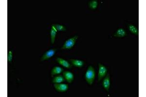 Immunofluorescent analysis of A549 cells using ABIN7176097 at dilution of 1:100 and Alexa Fluor 488-congugated AffiniPure Goat Anti-Rabbit IgG(H+L) (ZMYND11 antibody  (AA 363-513))